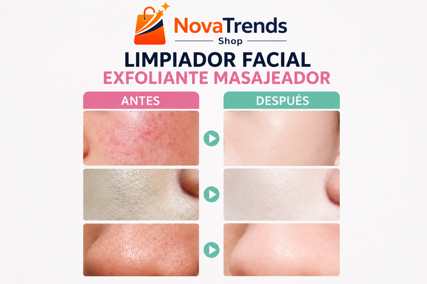 Limpiador Facial Exfoliante Masajeador